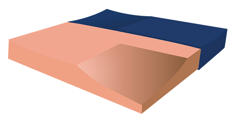 Produktbild Arthroseat Arthrodesensitzkissen