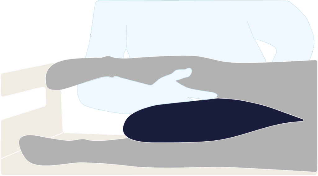 Illustration des Positionierungsbeispiels mit dem Spreizkissen