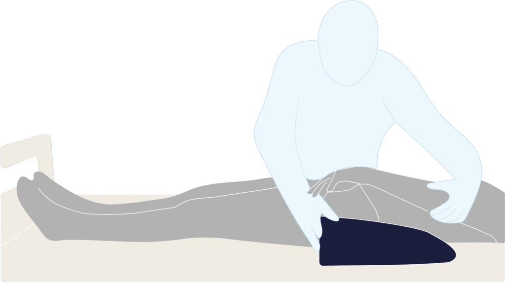 Illustration des Positionierungsbeispiels mit der Unterarmschiene